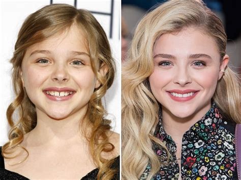 chloe grace moretz teeth|chloe grace moretz childhood photos.